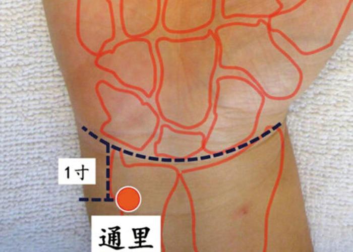 艾灸治疗不孕症，效果好吗？