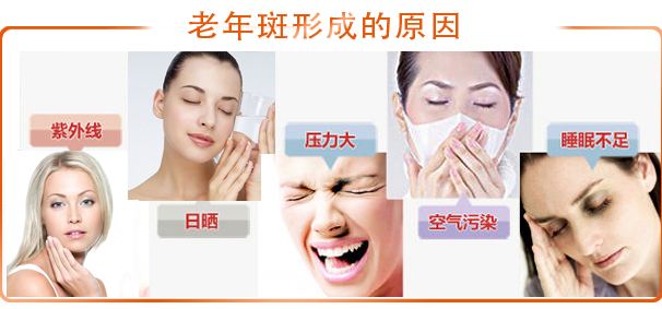 三招教你祛老人斑,老人斑怎么消除这一点太关键了