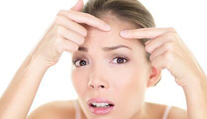 脸上长脓痘怎么办,脸上长脓痘怎么调理