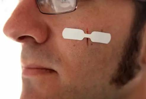 学习常见外伤的急救处理心得体会,外伤如何处理常见外伤应急小妙招