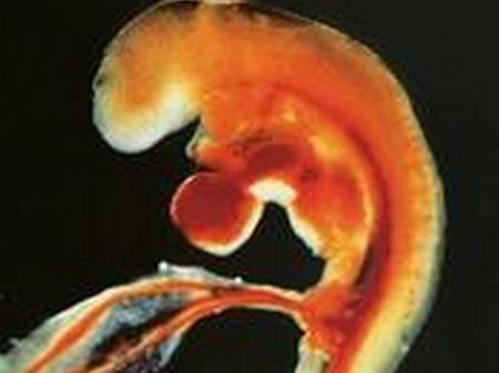 胎囊没有胎心胎芽是什么样的,有胎囊没有胎心胎芽什么原因