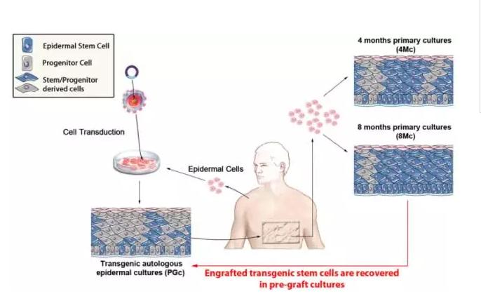 基因治疗遗传病会实现吗,基因治疗可以根治遗传病