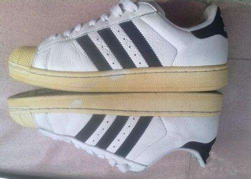 白鞋子发黄洗白三分钟恢复小窍门,小苏打加白醋能把发黄鞋子洗白吗