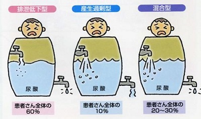 吃出来的痛风能看好吗,吃了痛风的药会吐吗