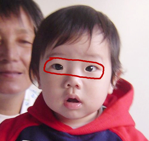 四岁孩子眼轴长得快怎样控制,婴儿犯四眼怎么解决