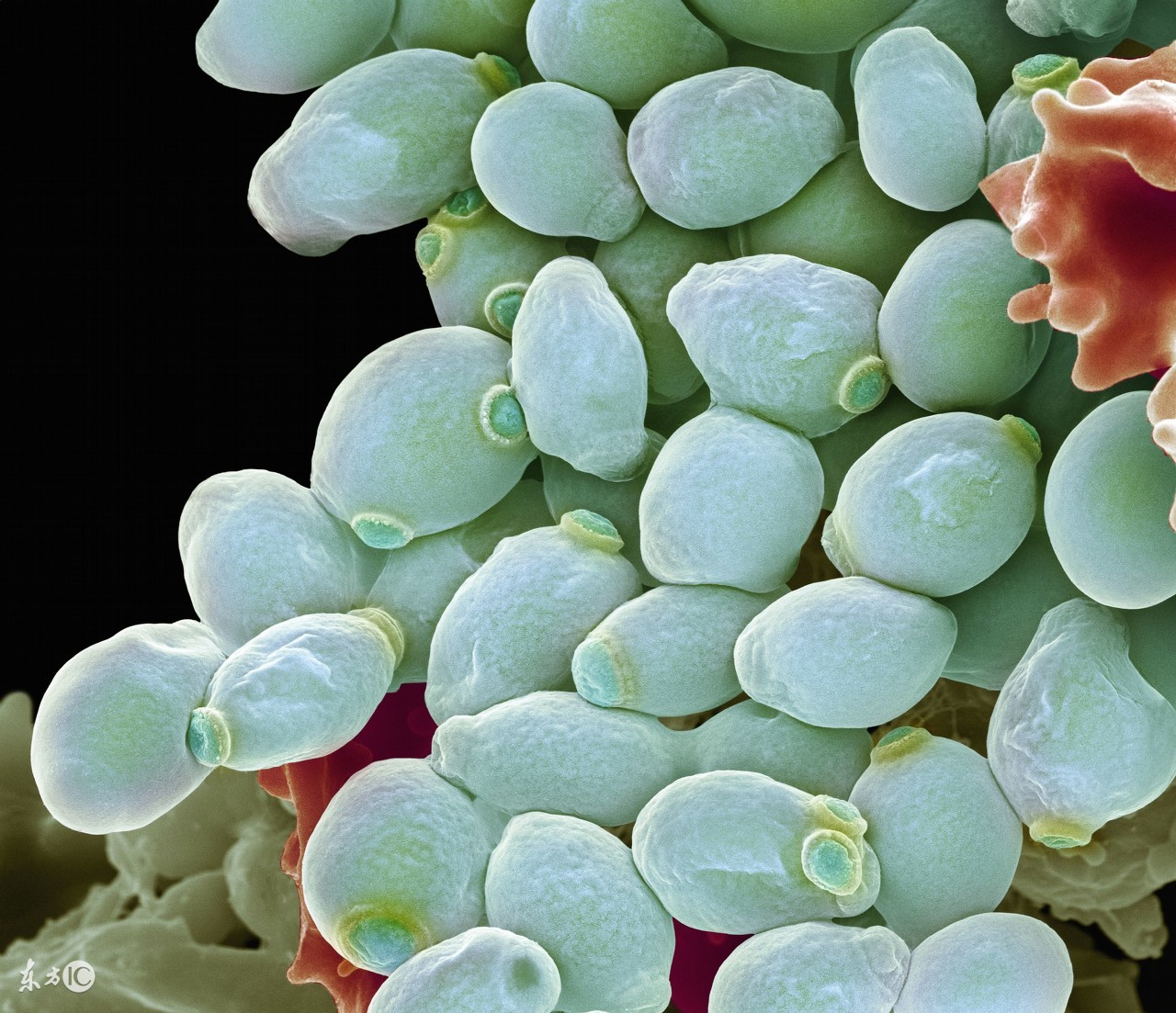 女人必须防的五种疾病,女人得这几种病必须男人治好