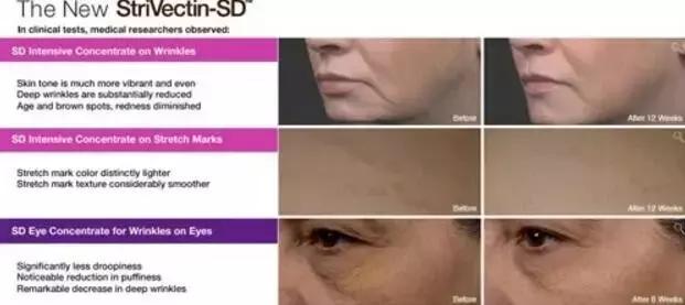 秋天给脸补补水,要给皮肤大量补水