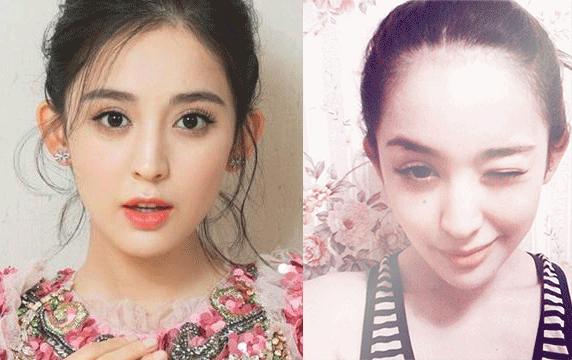 赵丽颖脸部痣,赵丽颖脸上美人痣