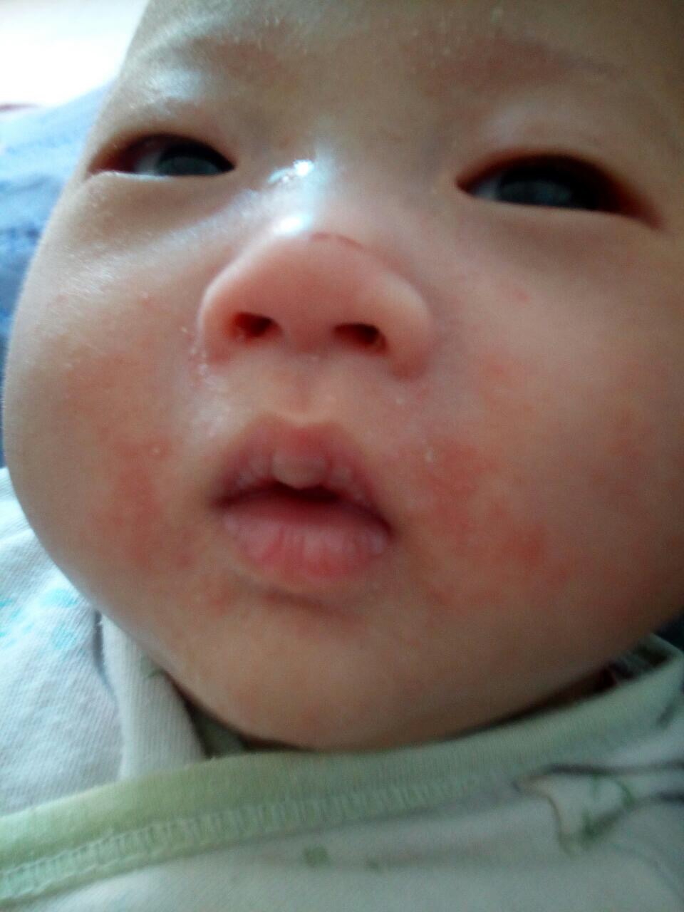 8个月宝宝第一次吃奶粉怎么给,七八个月宝宝辅食过敏怎么办