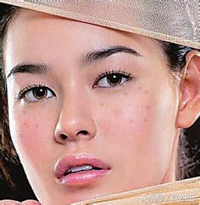 手脚冰凉怕冷身体疲倦,手脚冰凉怕冷一招搞定