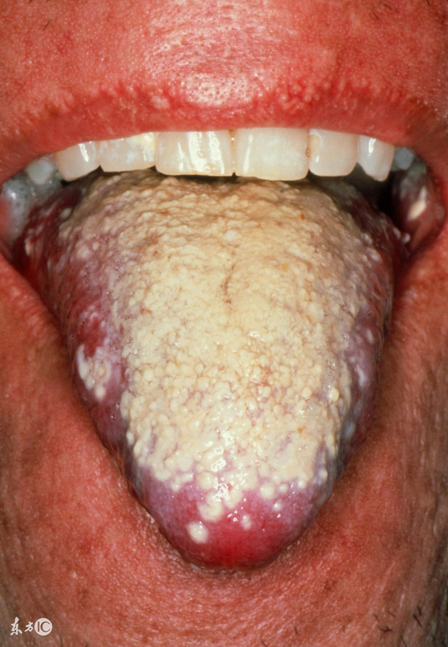 家有宝宝的一定要注意安全,家里有宝宝的注意啦