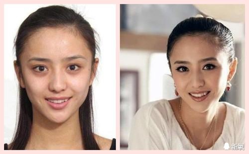 佟丽娅把*牙虎**磨掉了，其实她最该整的是眼睛！