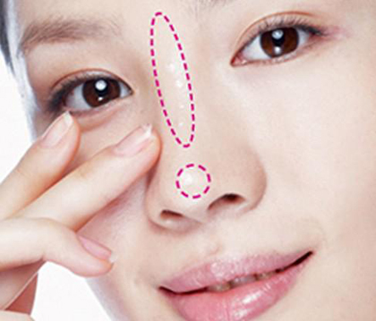 鼻子毛孔粗大泛红如何改善,鼻子毛孔粗大泛红用什么药膏