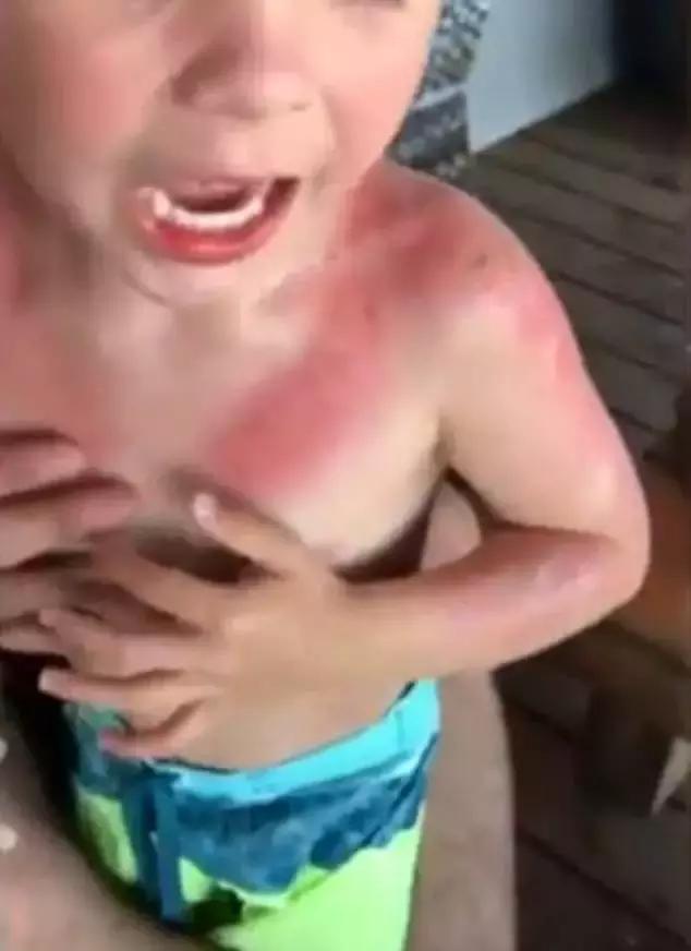 三岁宝宝防晒霜,涂防晒霜宝宝眼睛痛