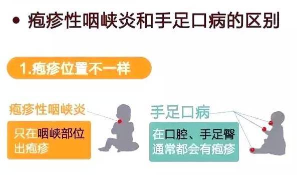 幼儿秋冬疾病预防全攻略,秋冬季节呼吸道疾病防治知识