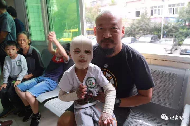 硬汉斌子：读懂创伤疤痕下的儿童