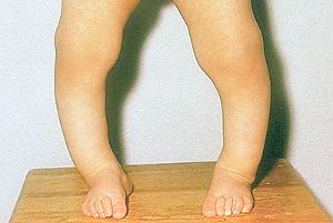 宝宝补充维生素d和ad要怎么补充,低体重儿补充维生素d和ad怎么吃