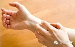 湿疹痒痒如何缓解,湿疹痒痒处能拍打么