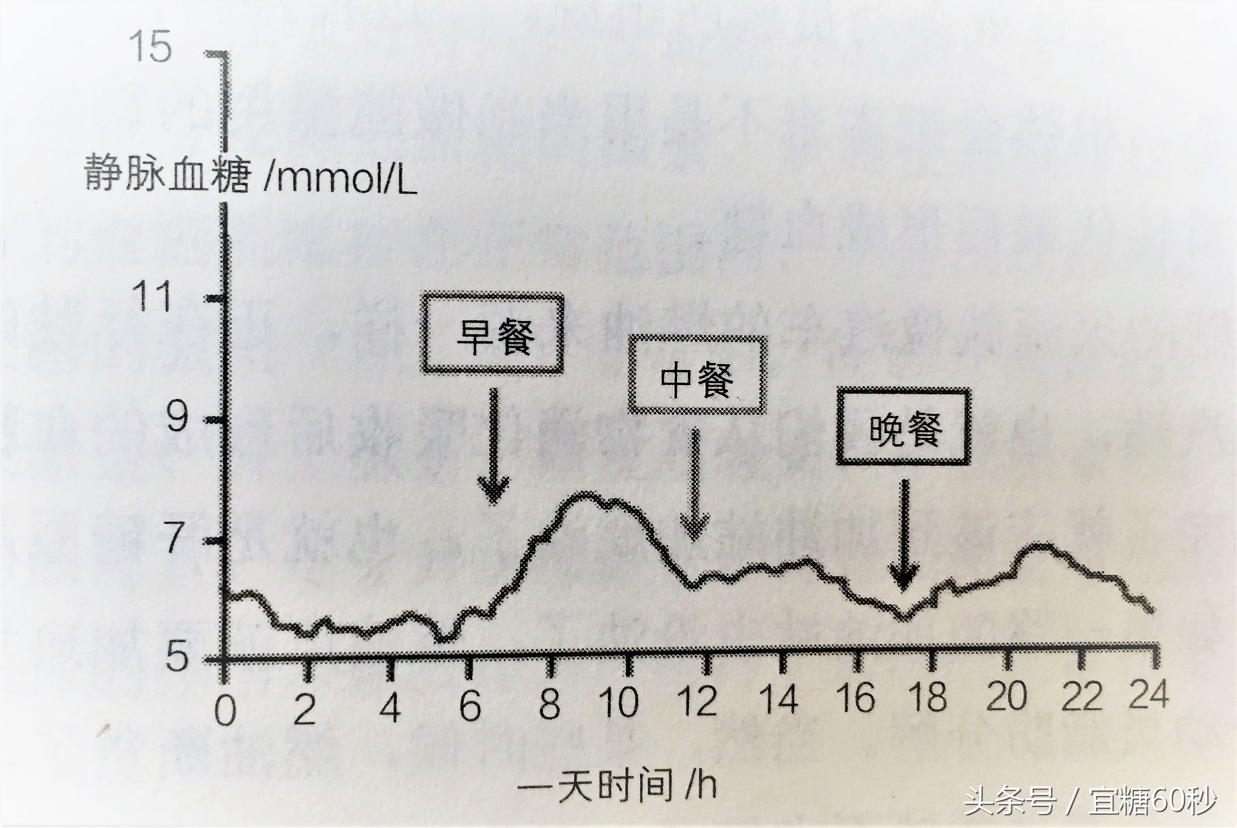 胰岛素分泌高峰延迟是糖尿病吗,血糖正常但是胰岛素分泌高峰延迟