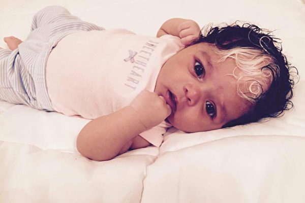 新生婴儿头顶白发,宝宝刚出生有几根白发