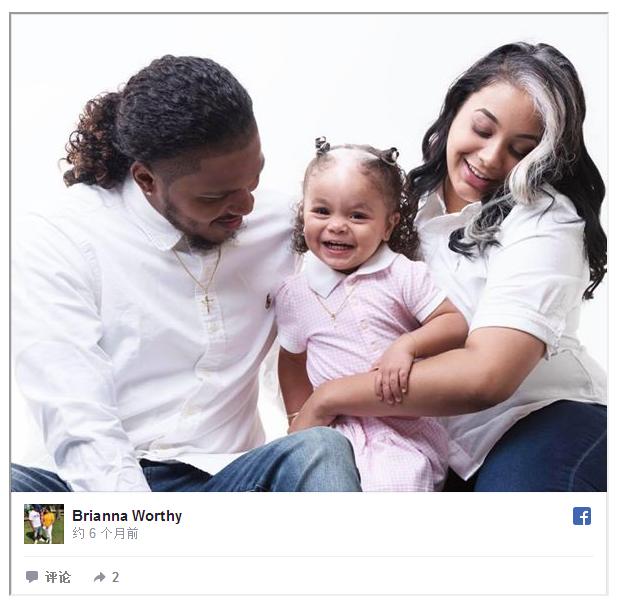 新生婴儿头顶白发,宝宝刚出生有几根白发