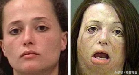 触目惊心吸毒前后真实的变化,吸毒的危害到底有多严重图片