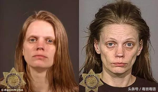 吸毒前后的变化对比,吸毒真的会毁容吗