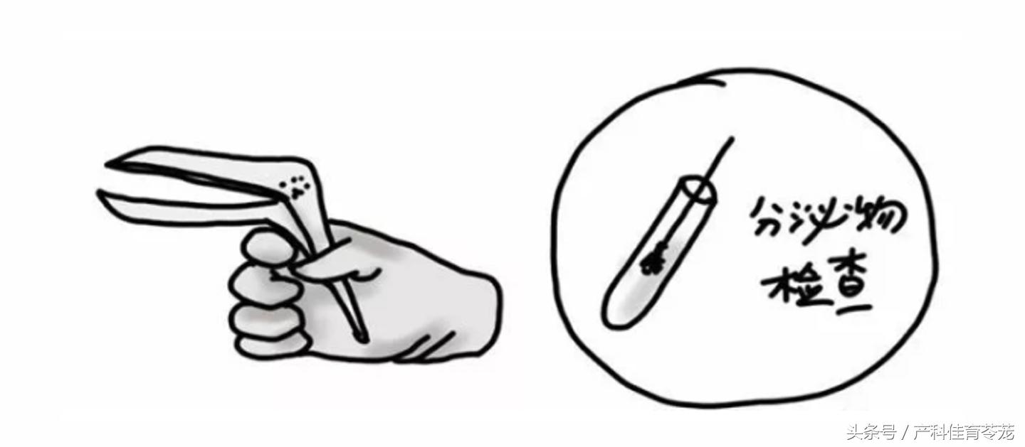 上环15天后还用避孕吗,上环前你应该详细了解这些知识