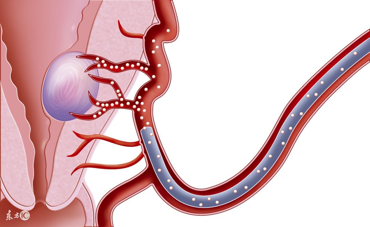 女性最大的私密问题,你还敢忽略吗?