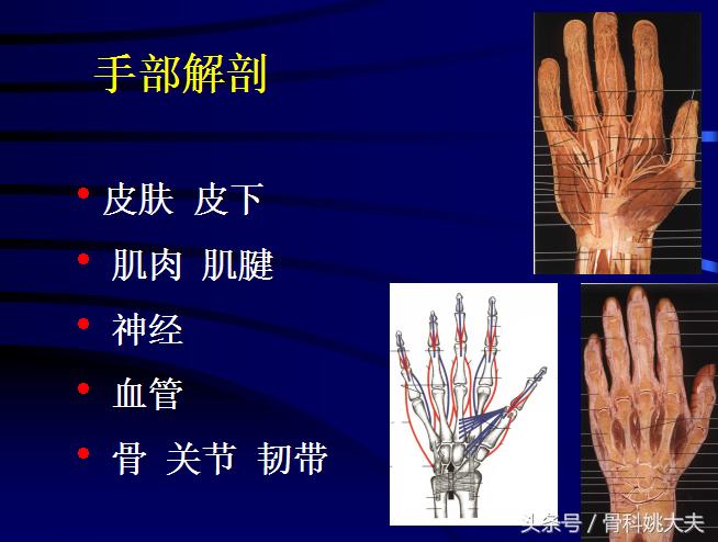 手肌腱损伤图片,手外伤神经肌腱损伤怎么定残