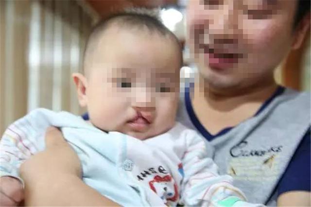 怀孕20周，孕检发现宝宝有轻微唇裂，原因只有自己清楚！