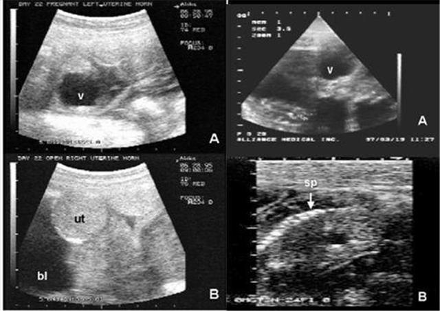 怀孕20周，孕检发现宝宝有轻微唇裂，原因只有自己清楚！