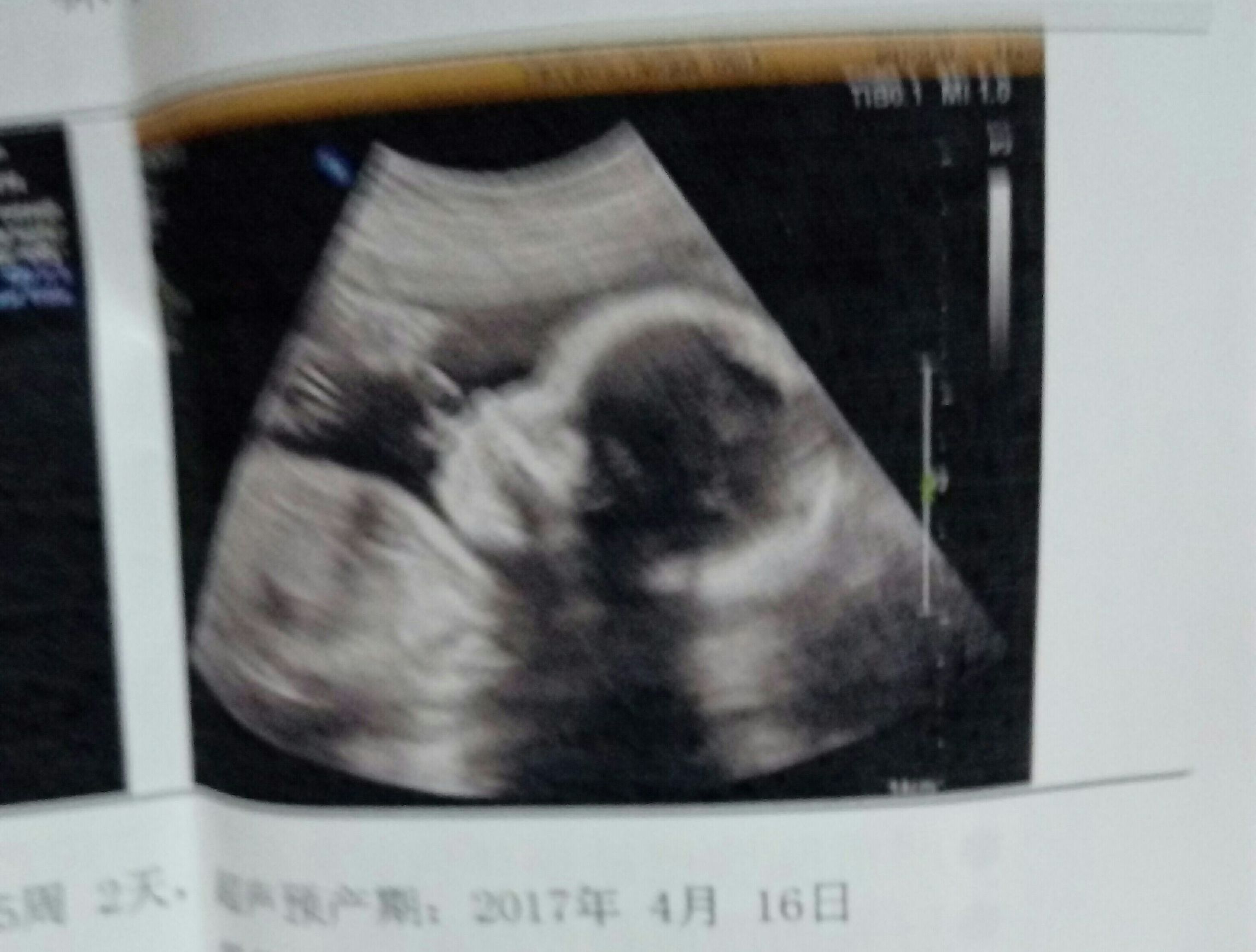 怀孕多久孕妇可以感觉到胎动,怀孕胎动位置示意图