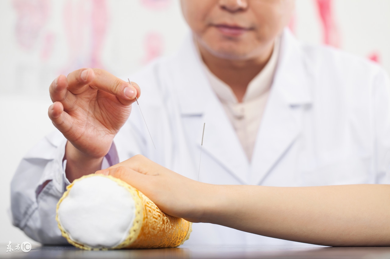 中医“萌新”的福利！针灸心得整理！