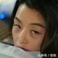 熬夜油痘肌什么样子,肌肤出油适合什么护肤品