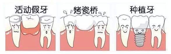 金属托假牙跟树脂托假牙哪种好,哪种假牙是比较好的