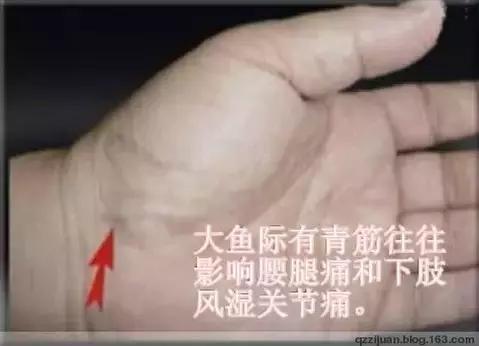 青筋的手诊方法,全身青筋诊病全集