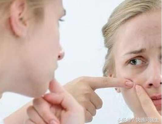 怎样祛除痘印痘坑小妙招,如何有效快速祛除痘印的方法