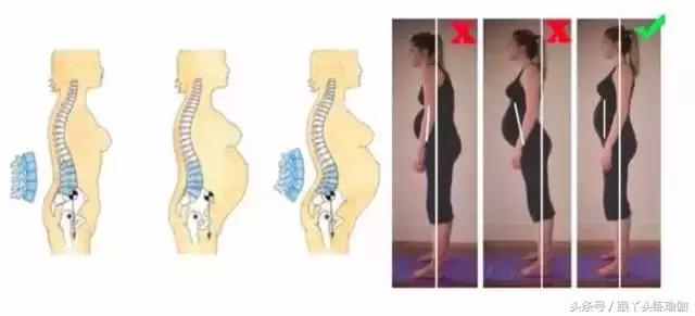 产后盆骨变形练瑜伽,产后4个月可以练瑜伽塑身吗