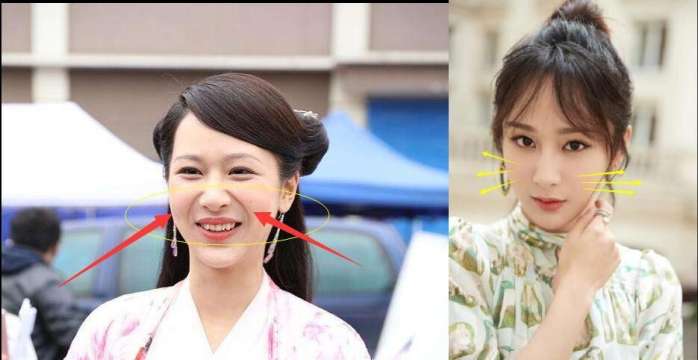 杨紫同款法令纹怎样去除,杨紫的法令纹怎么去掉的