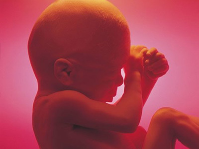 孕妇能吃牛蹄筋吗,孕妇羊水少怎么办啊