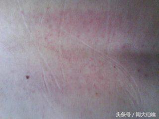 眼睛有沙用什么方法清理最快,超实用的眼镜小技巧