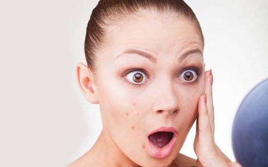 深红色的痘痘会是什么原因造成的,痘痘发炎和红色痘印有什么区别