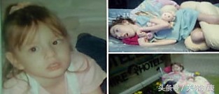 亲吻婴儿想示爱,但嘴里的病毒却给宝宝带来意外伤害