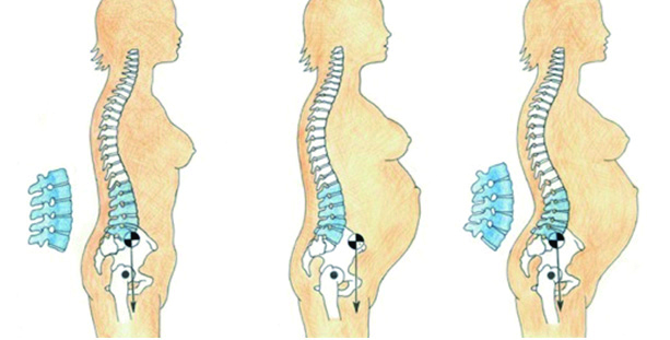 孕期腰背肌锻炼方法,孕期健康的基本方法有哪些