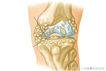 三甲医院通用的《疾病先兆自查表》，我用了几十年，现在还在用！