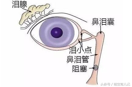 宝宝眼屎多解决办法视频,宝宝眼屎多需要通泪道吗