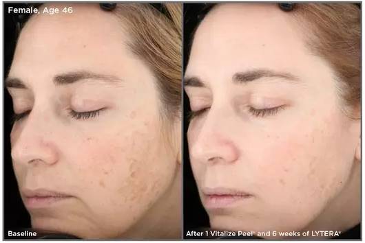 雅诗兰黛小棕瓶换哪种精华,雅诗兰黛小棕瓶配白泥