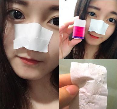 一招对付黑头,黑头清除大作战