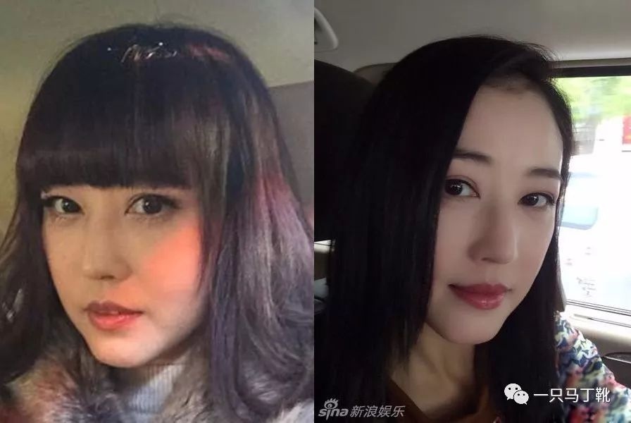 脸显宽怎么改善,怎样改善大小脸和方脸